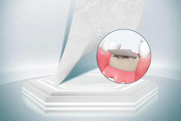 Zahn ärztliche chirurgische Materialien