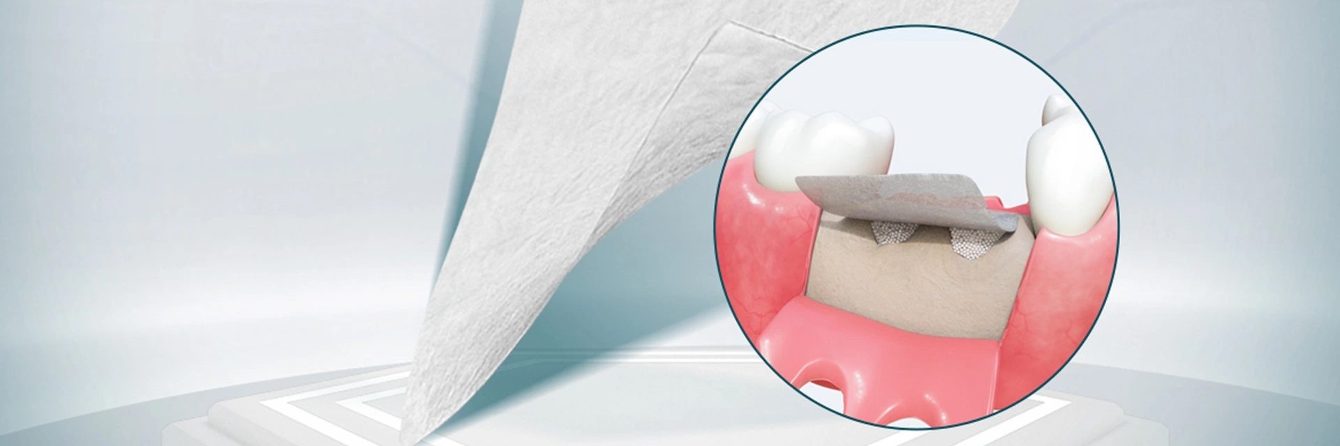 Zahn ärztliche chirurgische Materialien