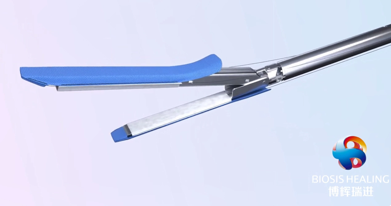 Heft linie Verstärkung für Ärmel gastrektomie für bariat rische Chirurgie