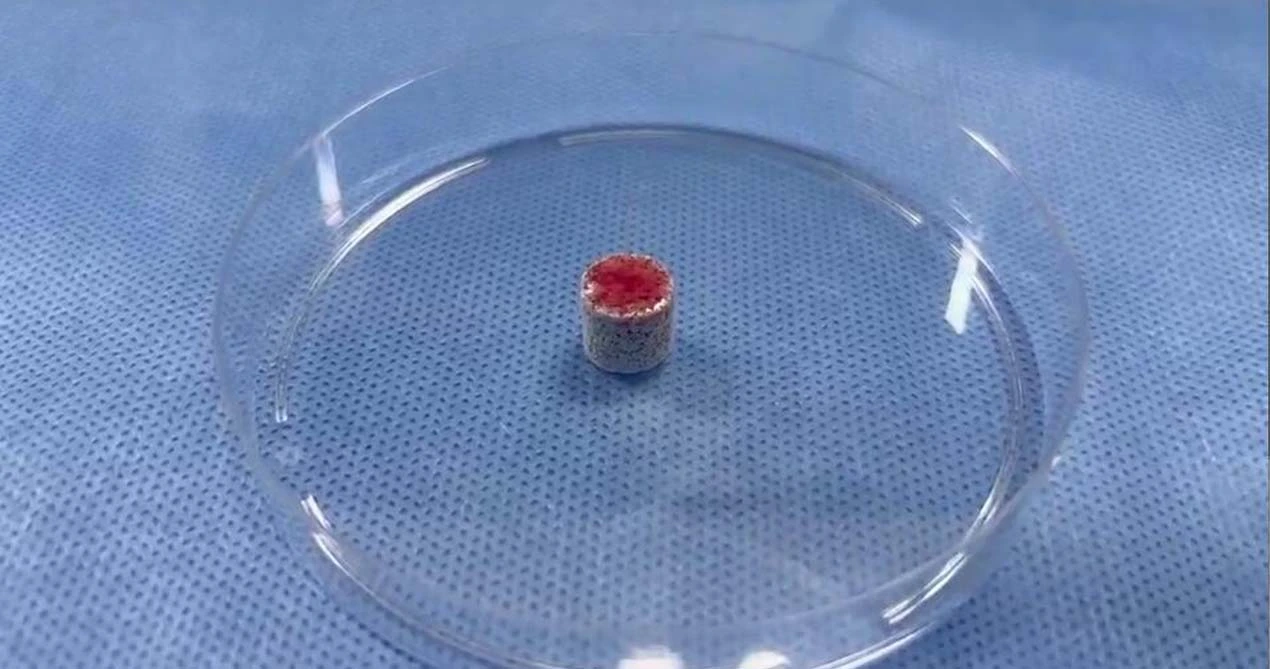 Knochen transplantation material